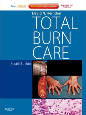 cover image of Total Burn Care E-Book